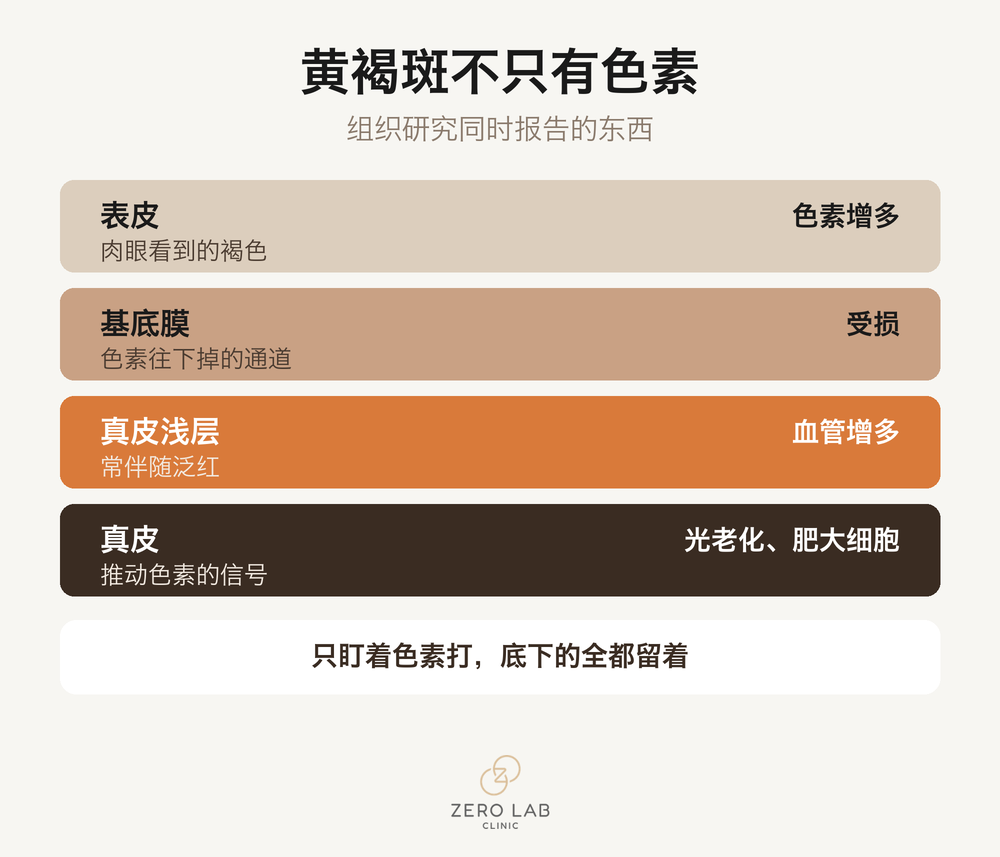 黄褐斑涉及的皮肤层次
