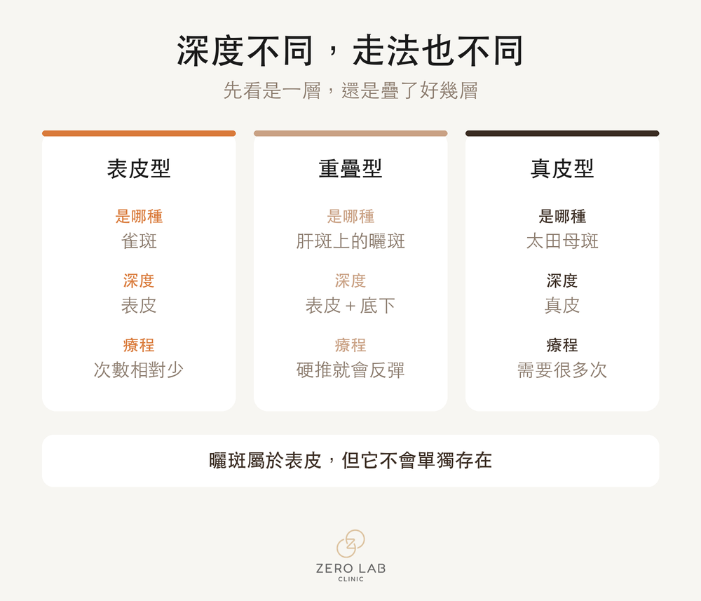 色素類型比較卡