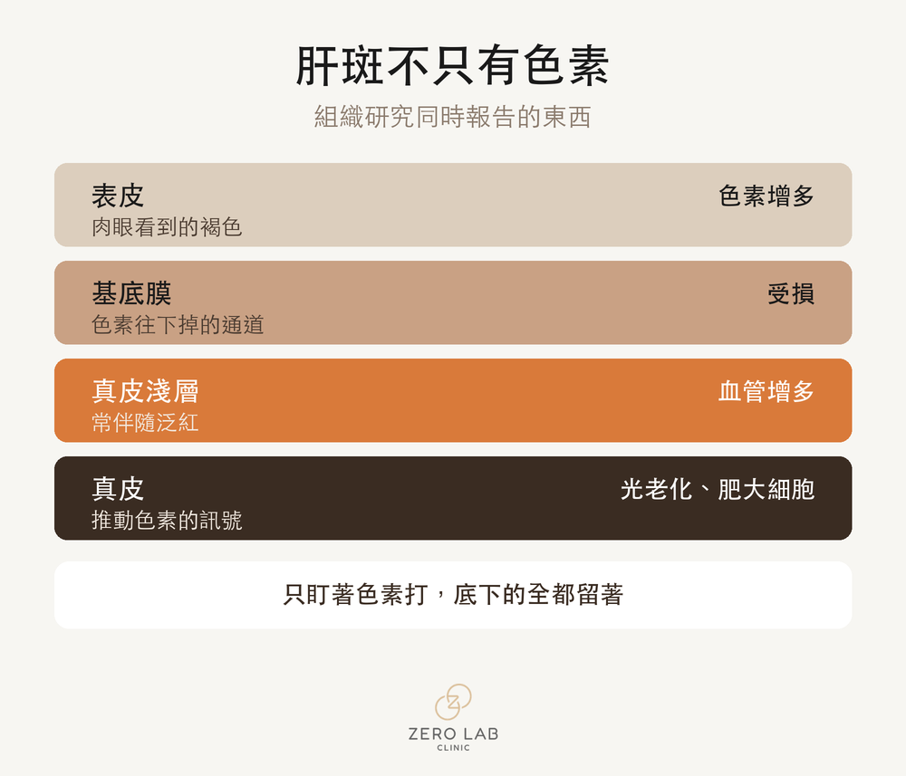肝斑所涉及的皮膚層次