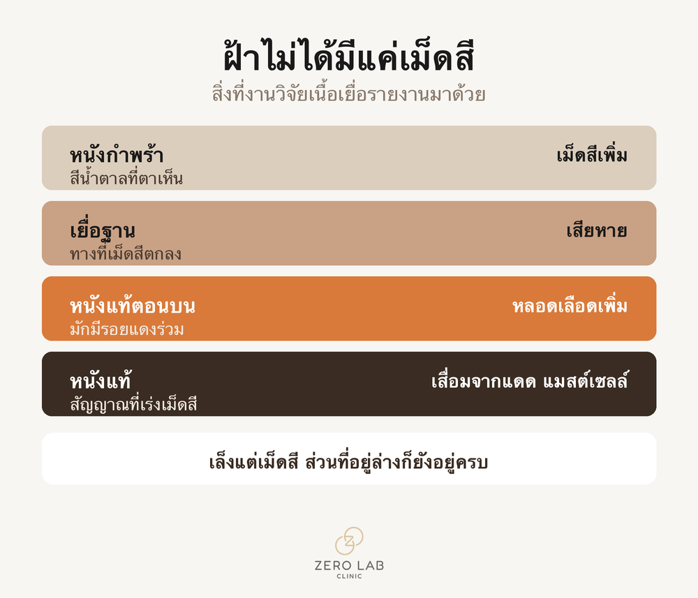 ชั้นผิวที่เกี่ยวข้องกับฝ้า