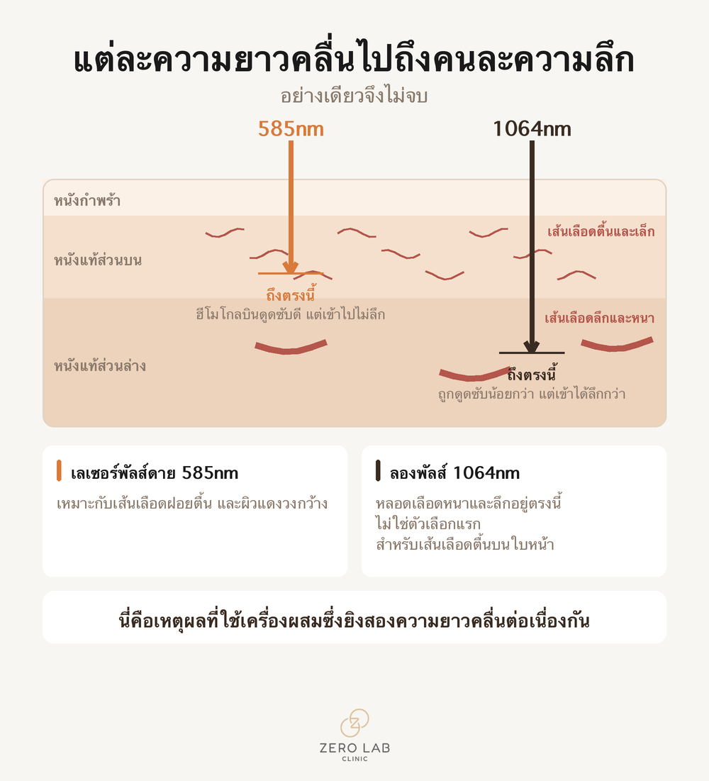 ภาพตัดขวางความลึกที่แต่ละความยาวคลื่นไปถึง