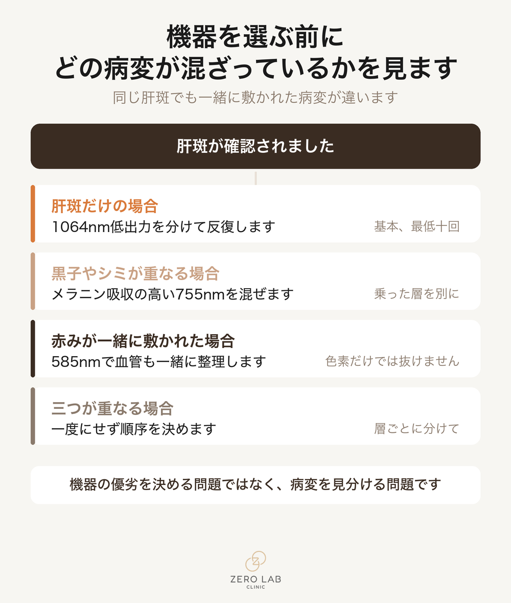 混ざっている病変に応じて波長を選ぶフローチャート