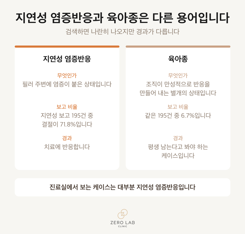 지연성 염증반응과 육아종을 나란히 놓은 비교 카드