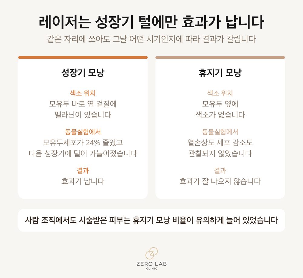 성장기 모낭과 휴지기 모낭의 레이저 반응 비교 카드