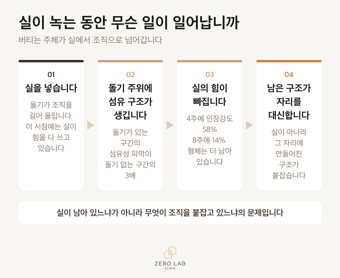 실이 흡수되는 동안 돌기의 힘은 빠지고 콜라겐이 자리를 대신하는 과정을 보여주는 흐름도