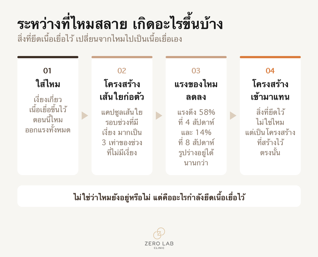 ผังลำดับที่แสดงกระบวนการที่แรงจากเงี่ยงลดลงและคอลลาเจนเข้ามาทำหน้าที่แทนในระหว่างที่ไหมถูกดูดซึม