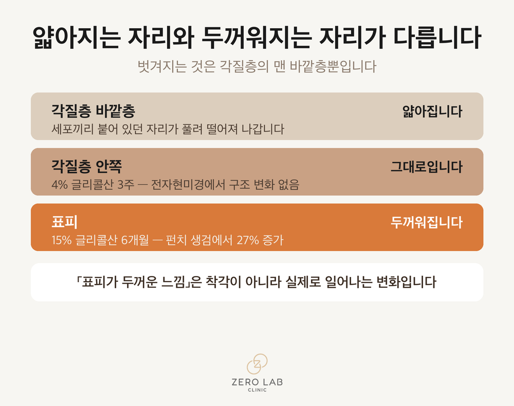 각질층 바깥 층은 벗겨지고 아래 표피는 두꺼워지는 두 방향의 변화를 나란히 놓은 비교