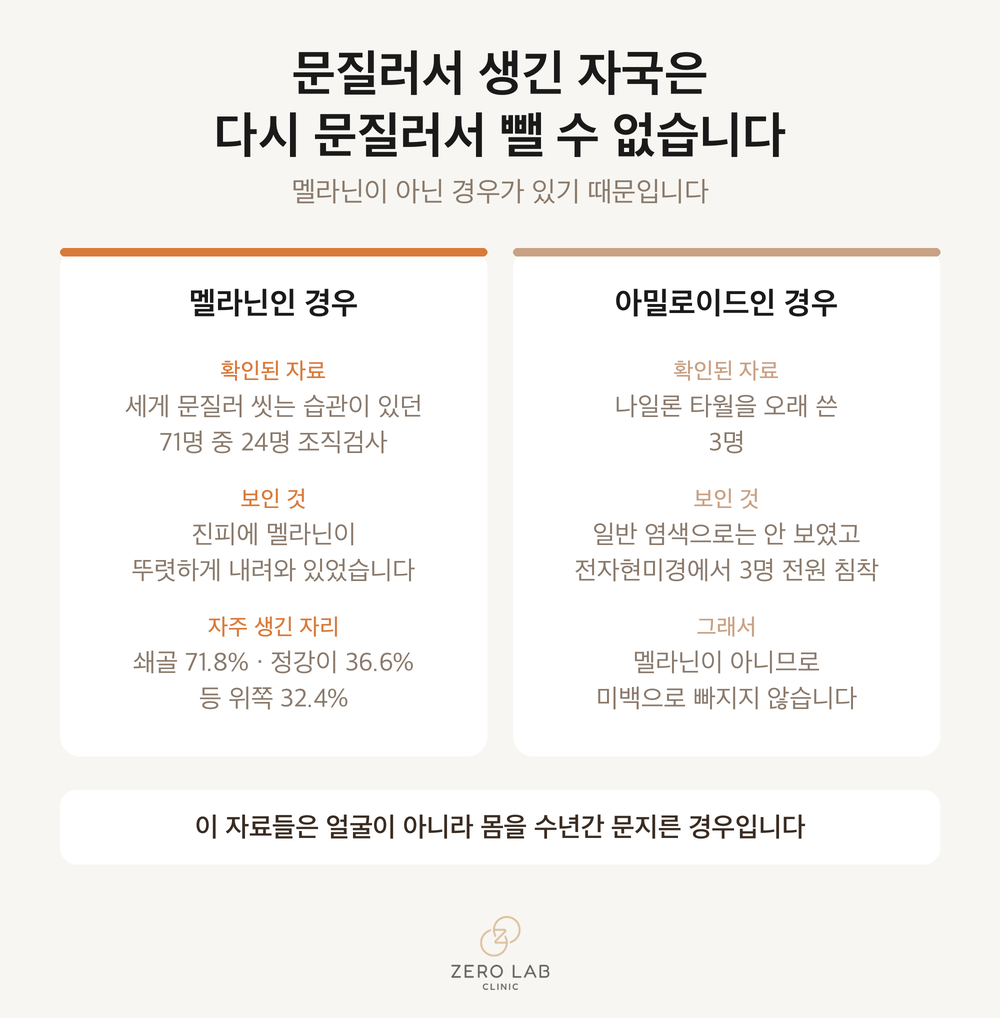 문질러 생긴 자국이 멜라닌인 경우와 아밀로이드인 경우를 나눈 비교 카드
