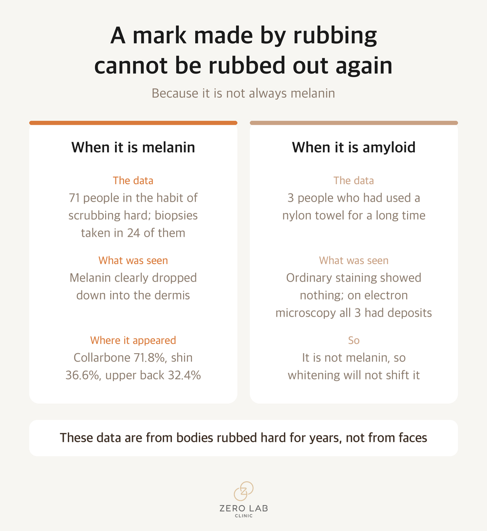 Comparison cards separating marks left by rubbing into those that are melanin and those that are amyloid