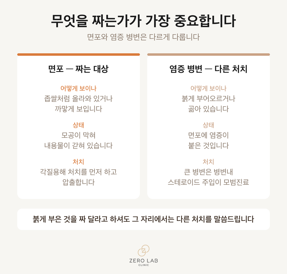 면포와 염증성 병변을 나란히 놓고 각각 어떻게 다루는지 나눈 비교 카드