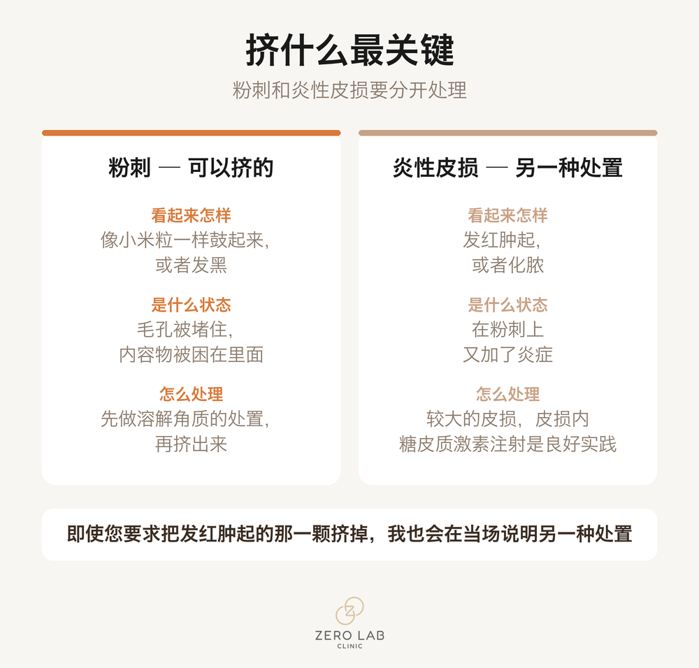 把粉刺与炎性皮损并排放在一起、分别说明如何处理的对比卡