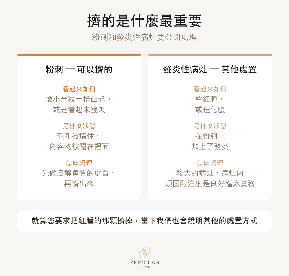 把粉刺與發炎性病灶並列、分別說明各自如何處理的對照卡