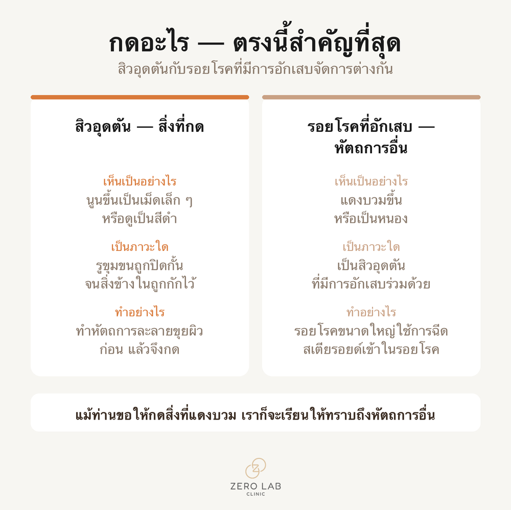 การ์ดเปรียบเทียบที่วางสิวอุดตันกับรอยโรคที่มีการอักเสบเรียงกัน และแยกว่าจัดการแต่ละอย่างอย่างไร