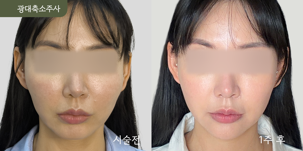 시설 이미지 10