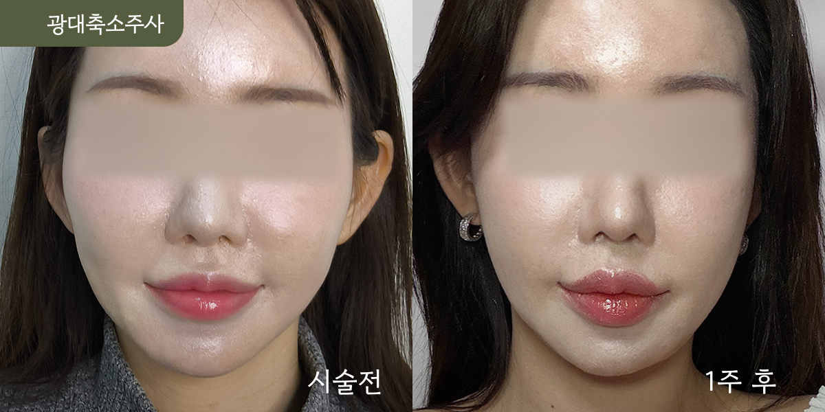 시설 이미지 12