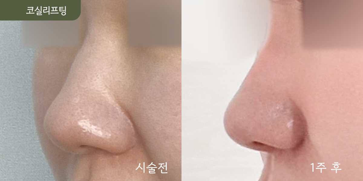시설 이미지 13