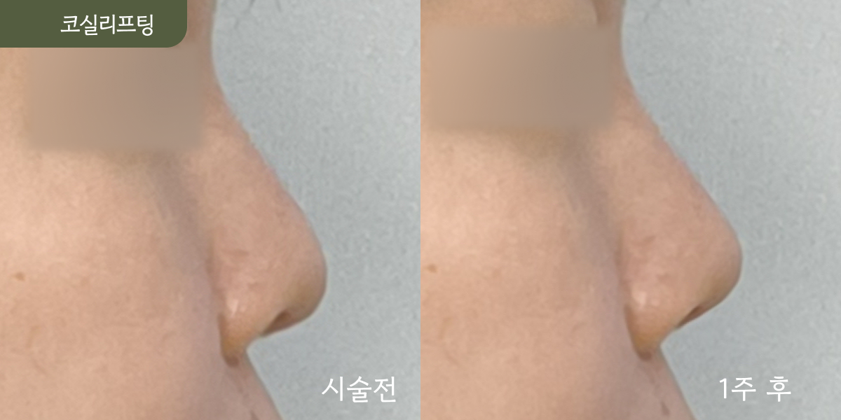 시설 이미지 14