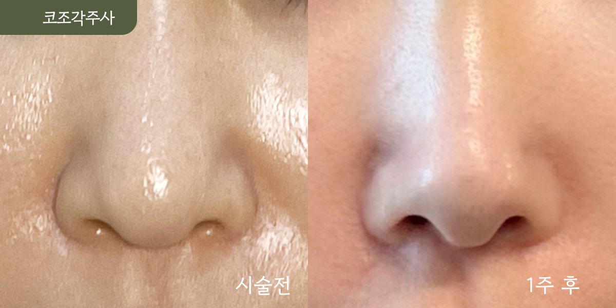 시설 이미지 15