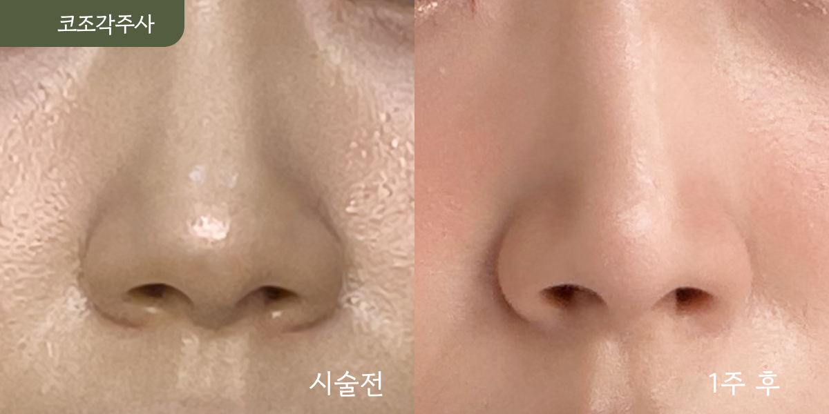 시설 이미지 17