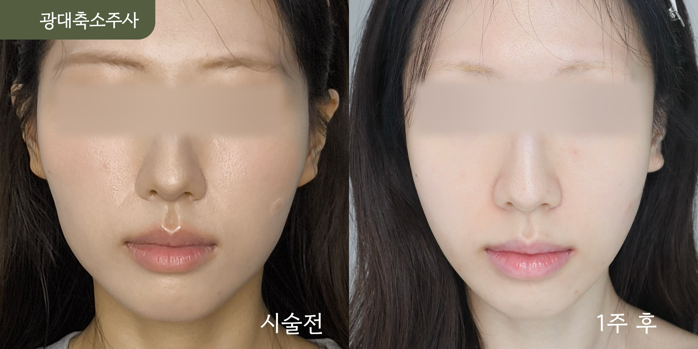시설 이미지 18