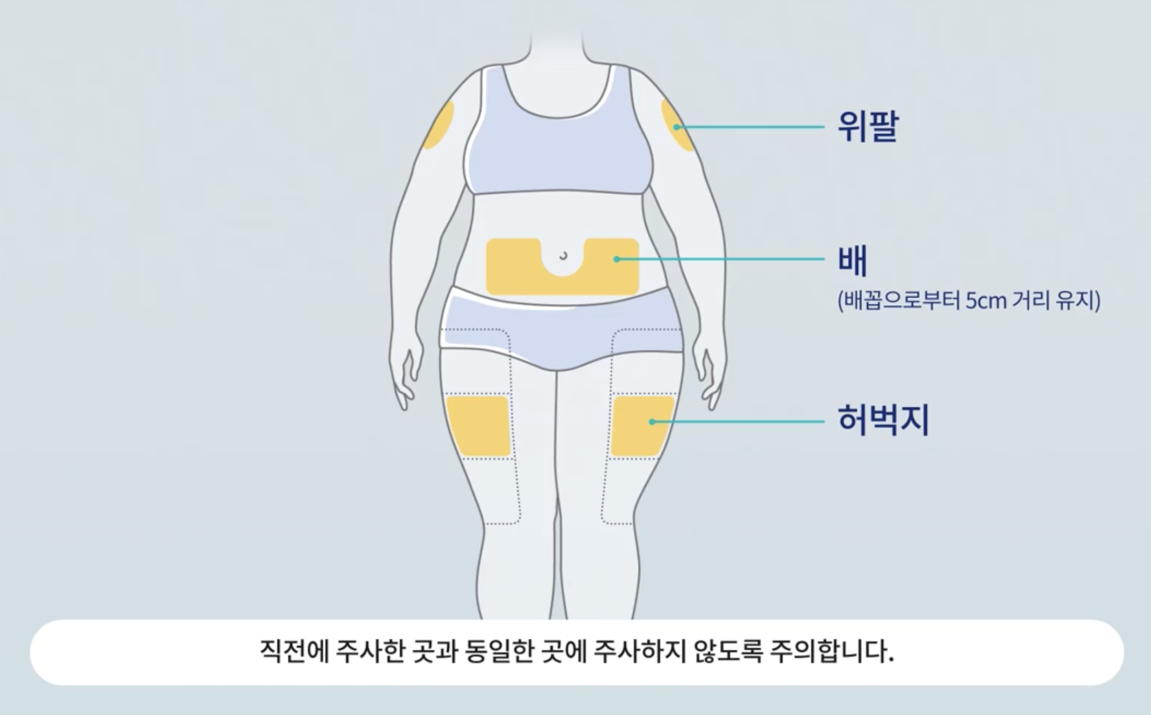 방법1