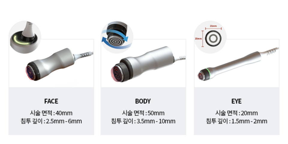 토르 시술 특징
