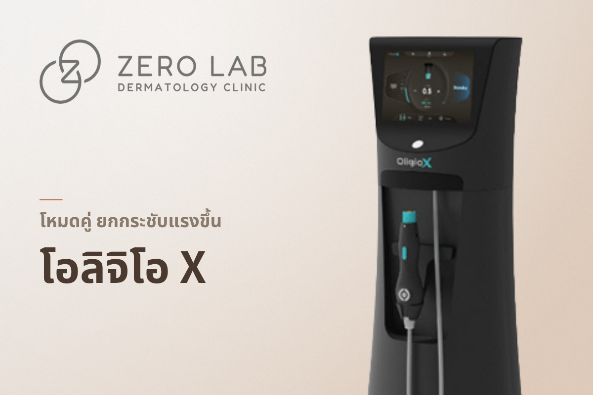 โอลิจิโอ X