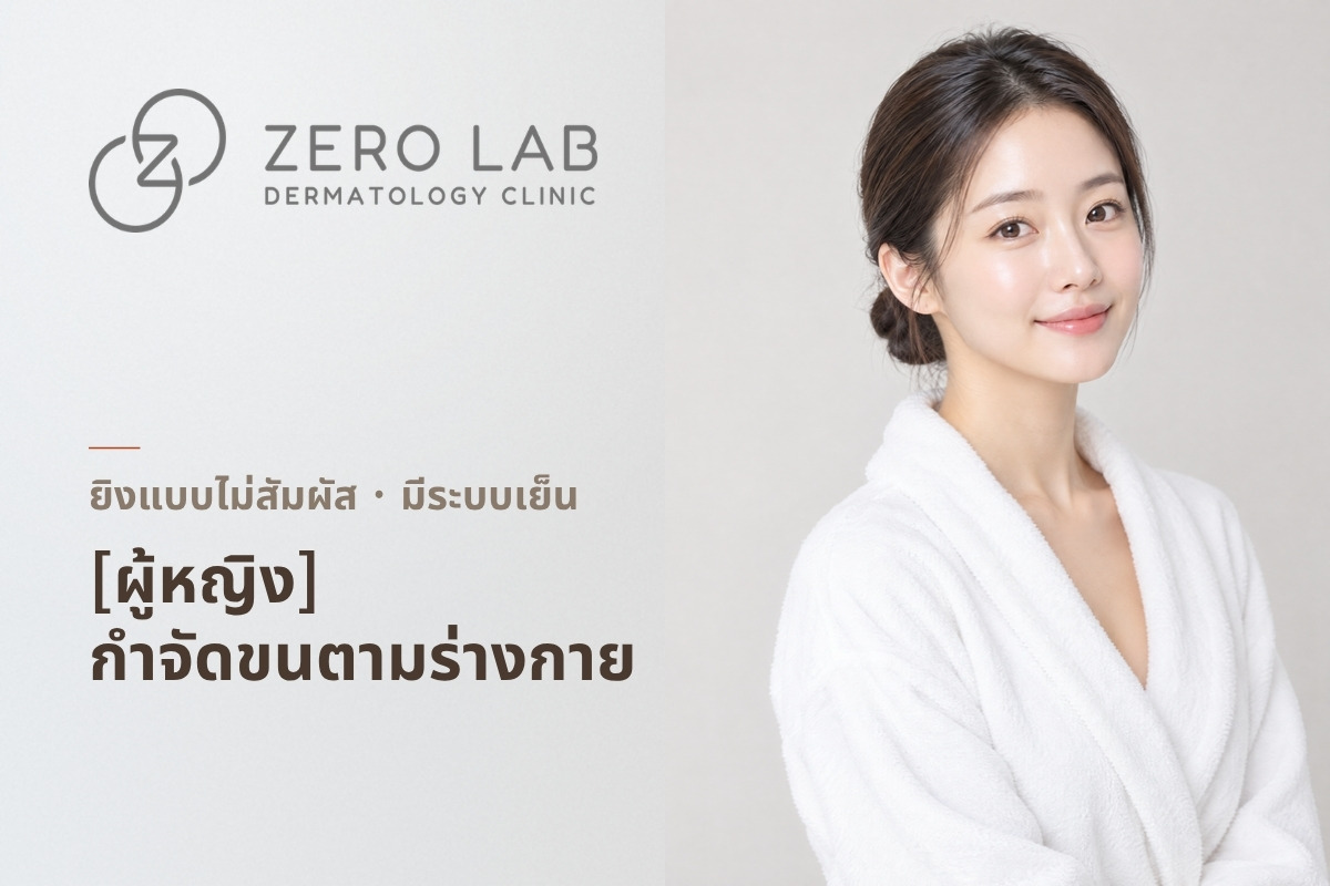 [ผู้หญิง] การกำจัดขนด้วยเลเซอร์ Elite Plus บนร่างกาย