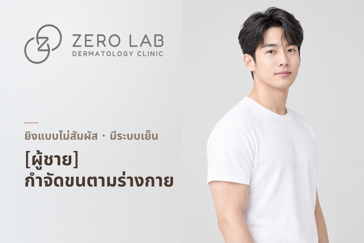 [ชาย] การกำจัดขนด้วยเลเซอร์ Elite Plus