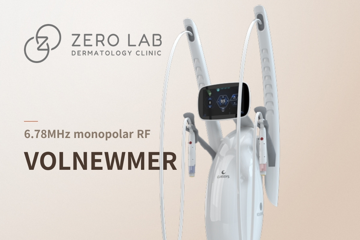 VOLNEWMER