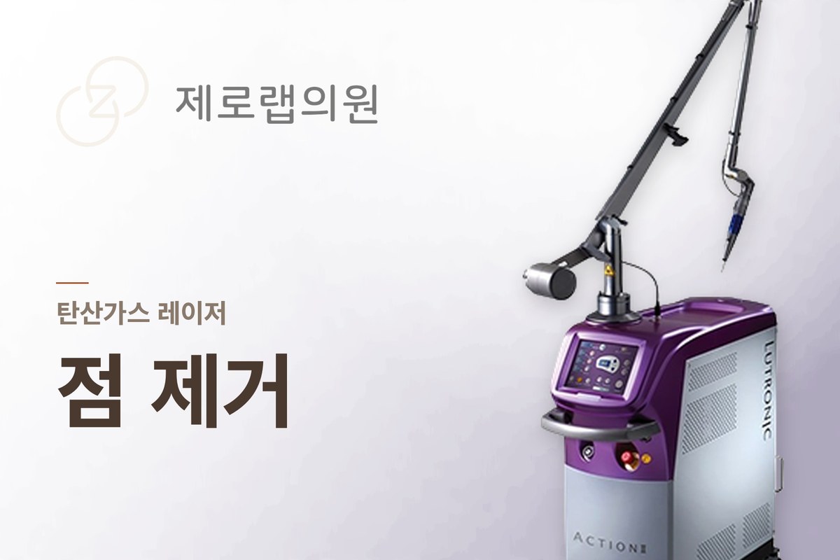 점제거