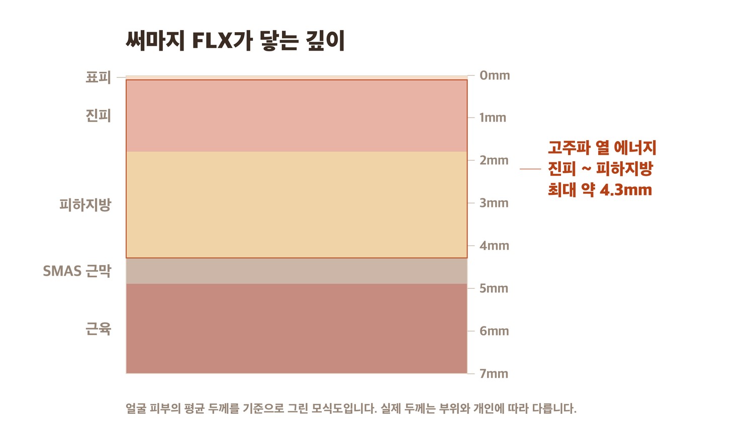써마지 FLX 고주파가 닿는 피부 깊이 단면 모식도 — 진피에서 피하지방까지 최대 약 4.3mm