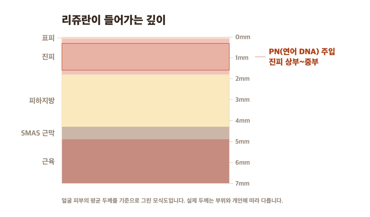 리쥬란 PN이 주입되는 피부 깊이 단면 모식도 — 진피 상부에서 중부