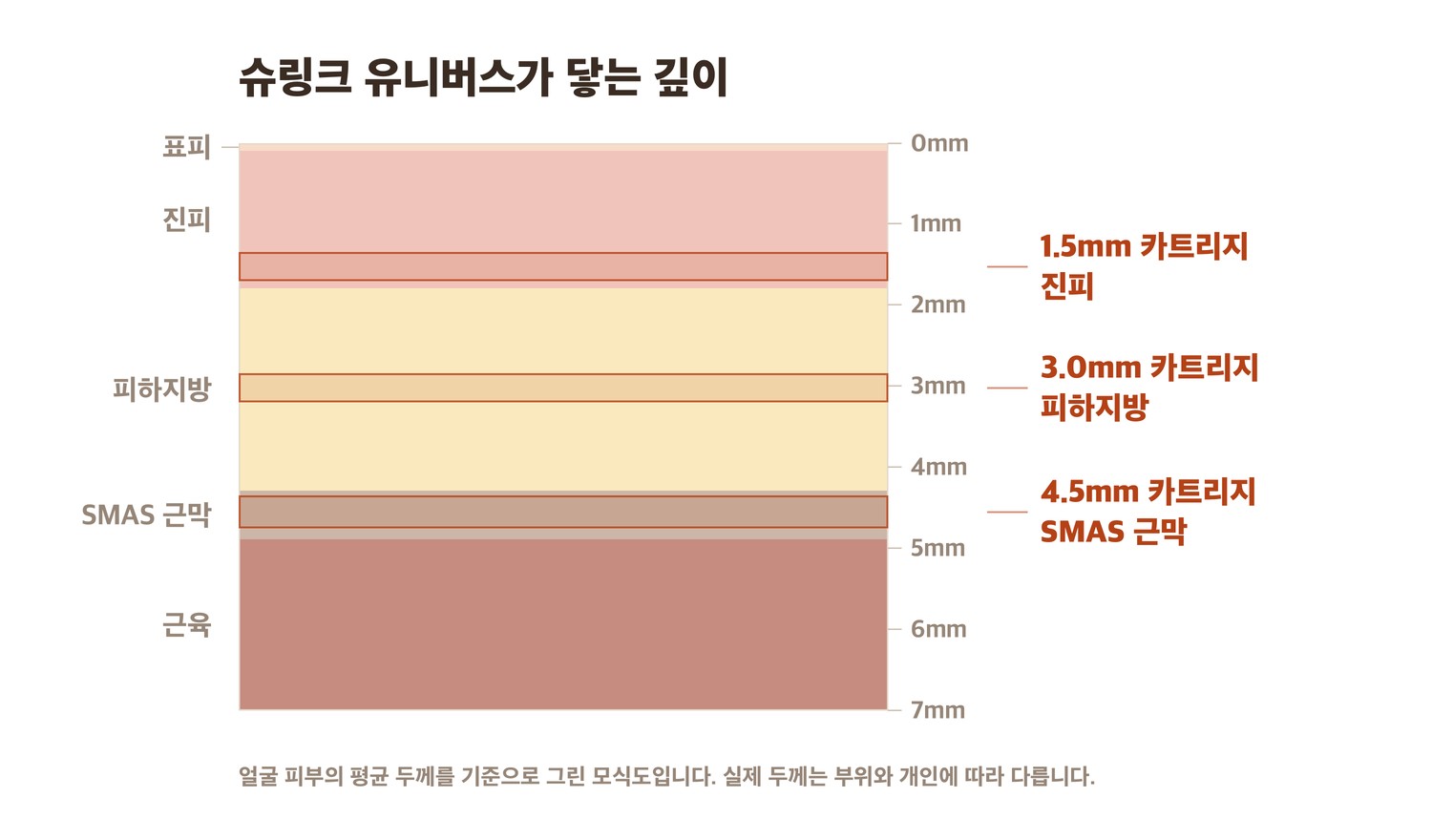 슈링크 유니버스 카트리지별 도달 깊이 단면 모식도 — 1.5mm 진피, 3.0mm 피하지방, 4.5mm SMAS 근막