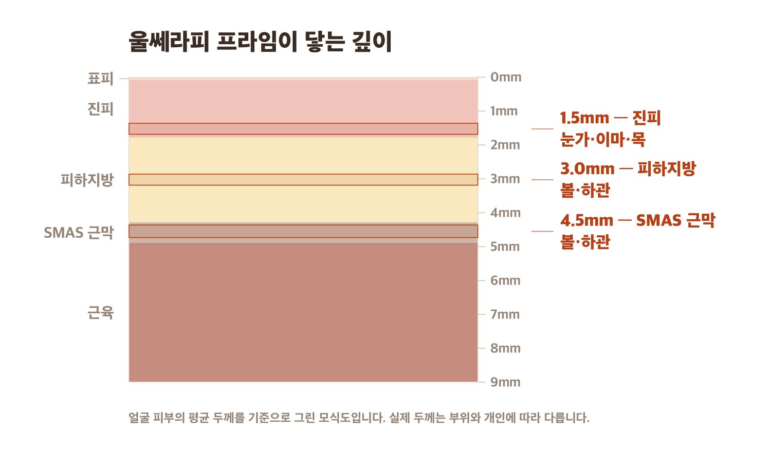 울쎄라피 프라임의 1.5mm·3.0mm·4.5mm 도달 깊이 단면 모식도