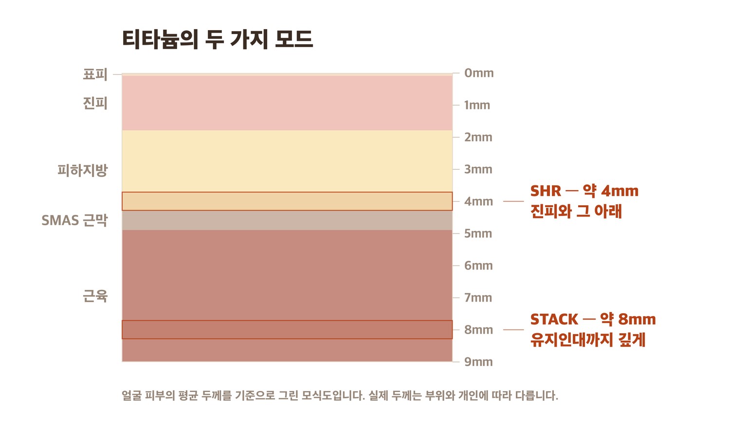 티타늄 STACK 모드와 SHR 모드가 닿는 깊이 단면 모식도