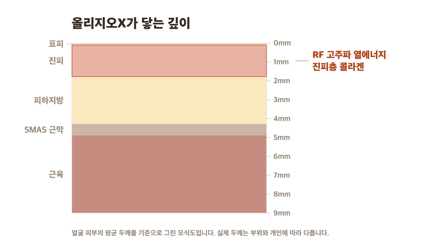 올리지오X 고주파가 닿는 진피층 단면 모식도