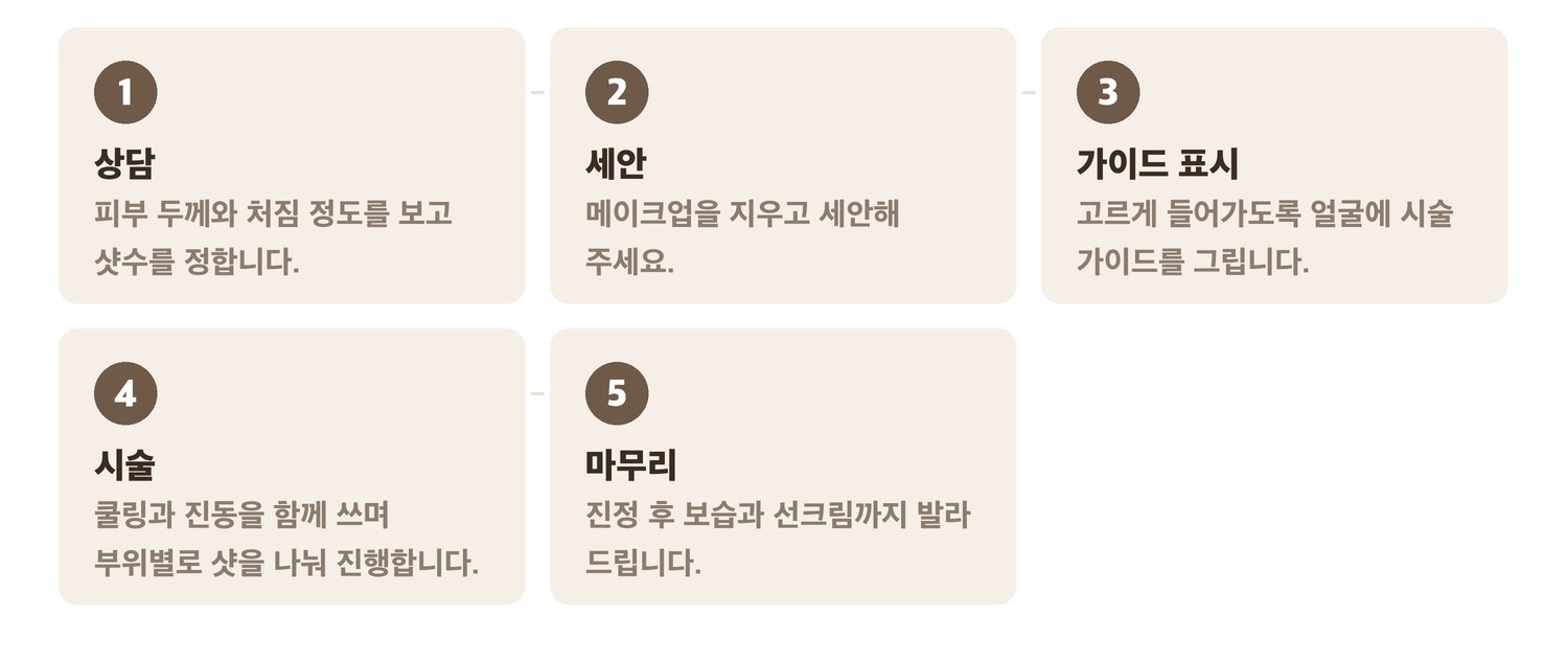 올리지오X 시술 진행 순서 5단계