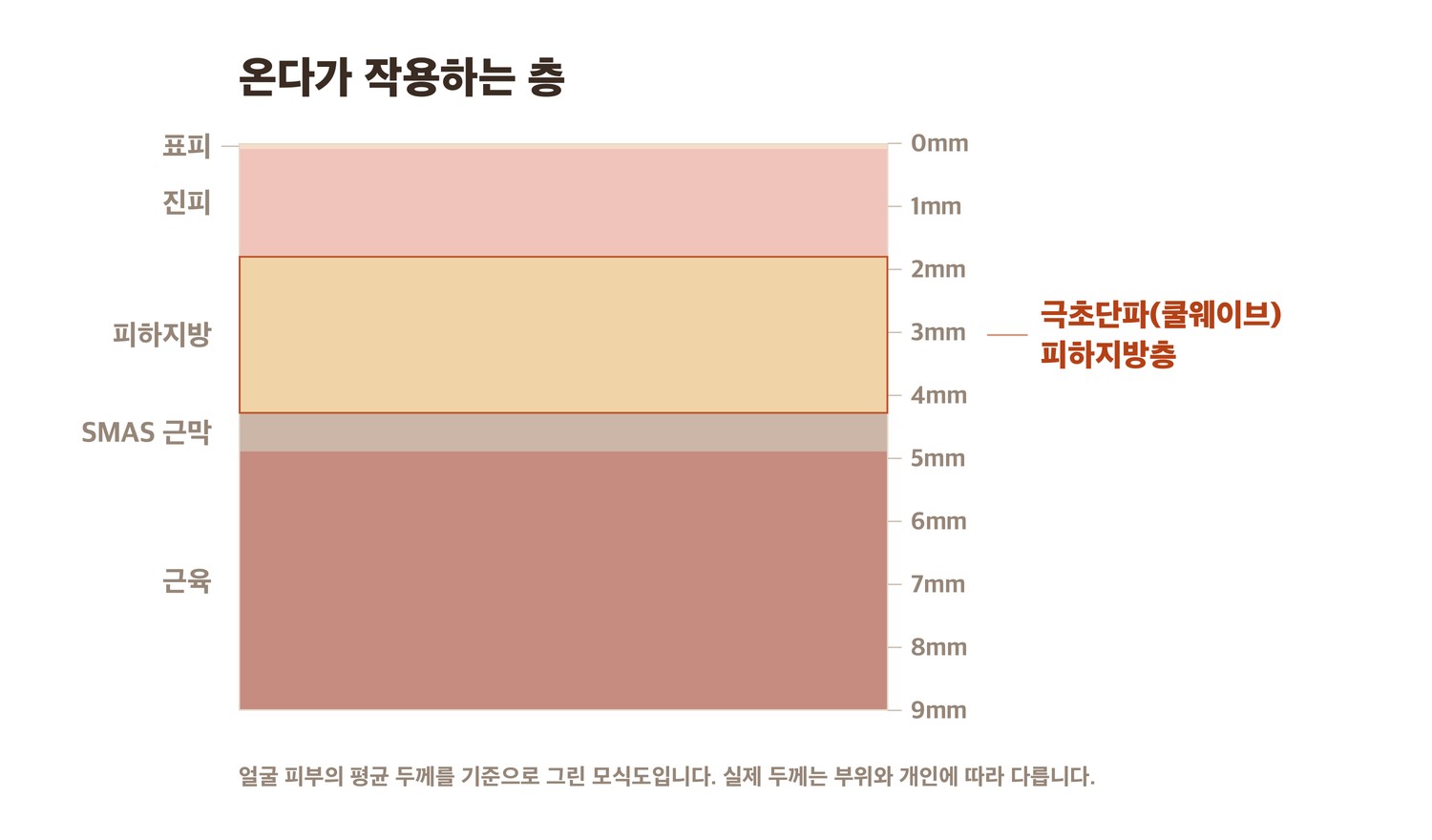 온다 극초단파가 작용하는 피하지방층 단면 모식도