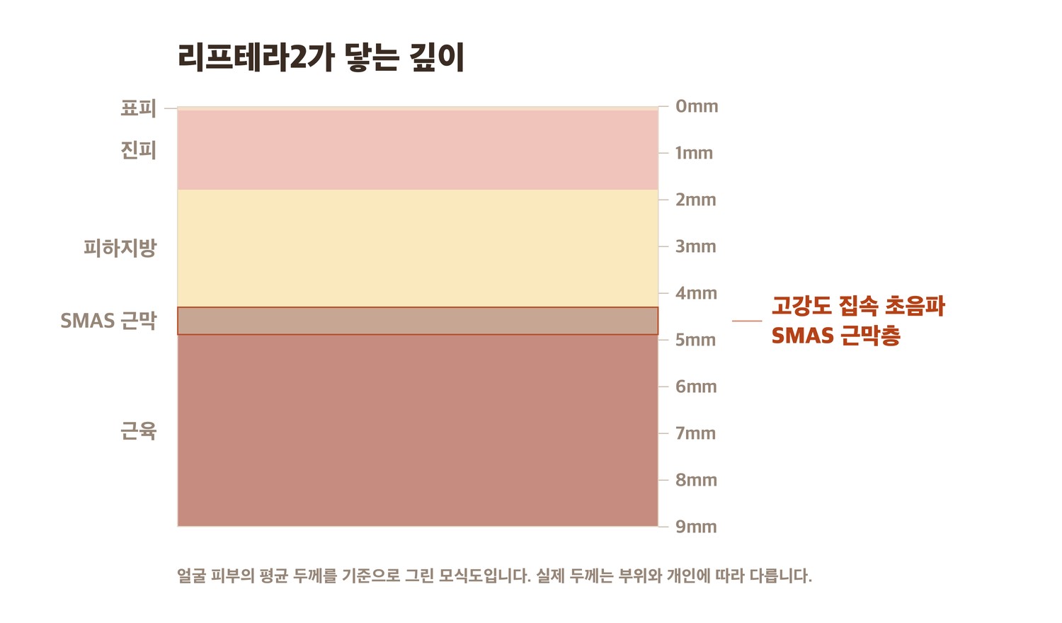 리프테라2 초음파가 닿는 SMAS 근막층 단면 모식도