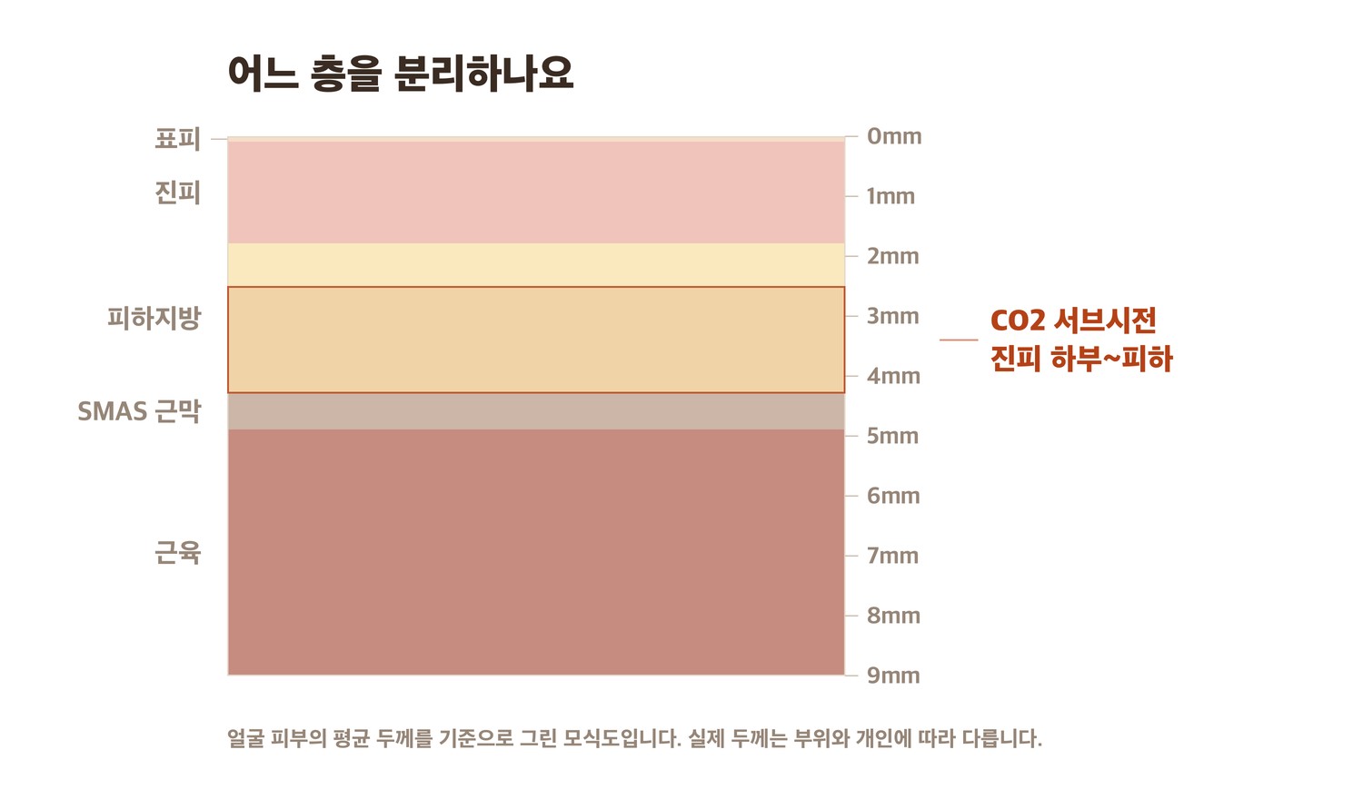 트리필 CO2 서브시전이 작용하는 진피 하부 단면 모식도