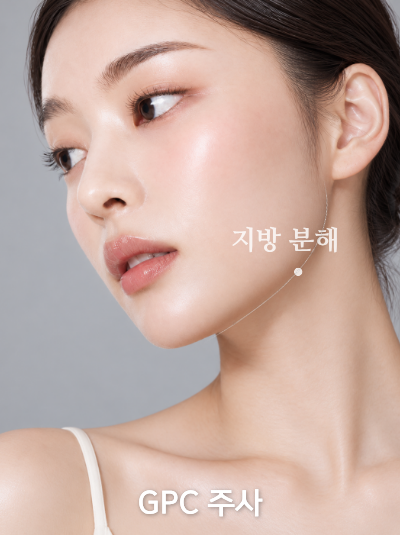 GPC주사