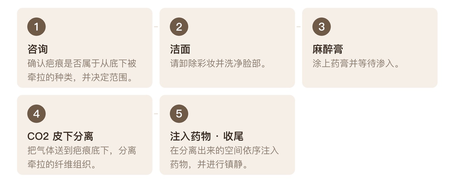 TriFill 疗程流程 5 个步骤