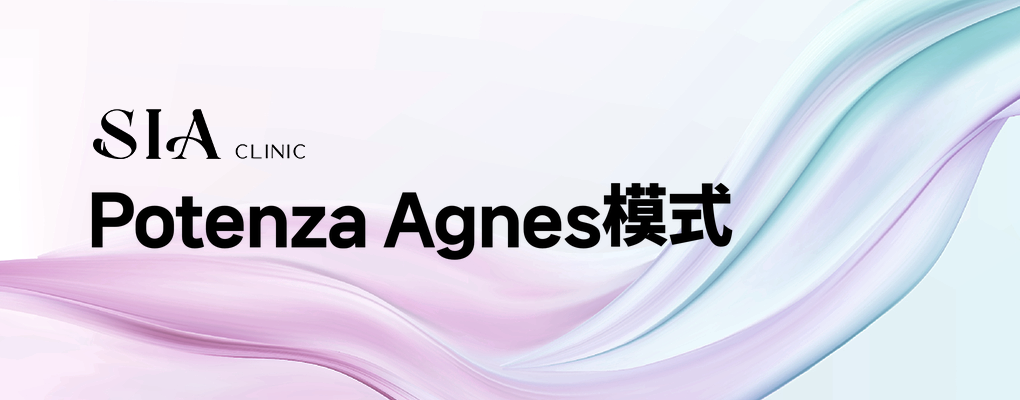 Potenza Agnes模式