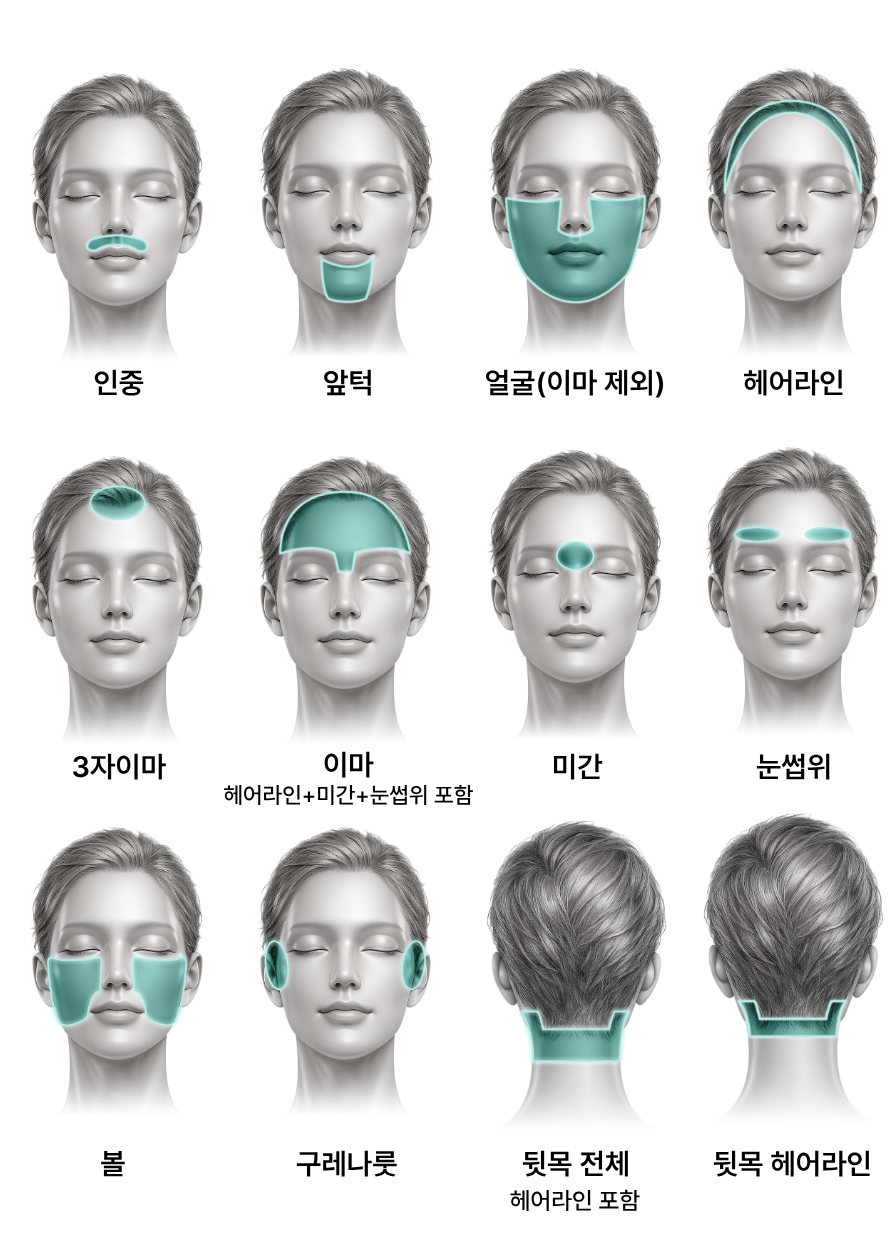 얼굴 제모(여성)