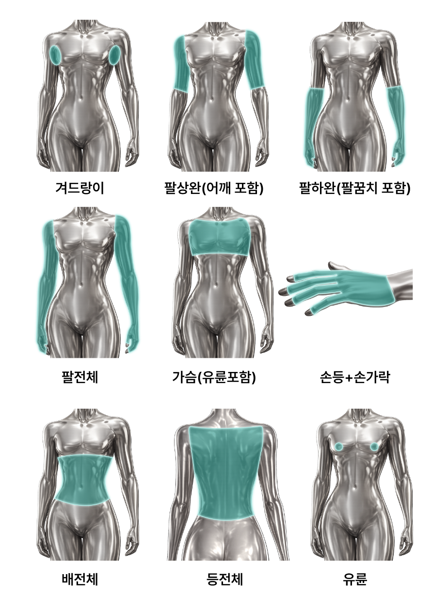 상체 제모(여성)