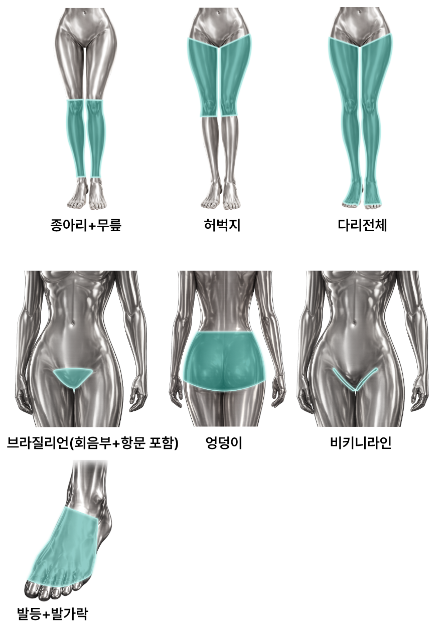 하체 제모(여성)