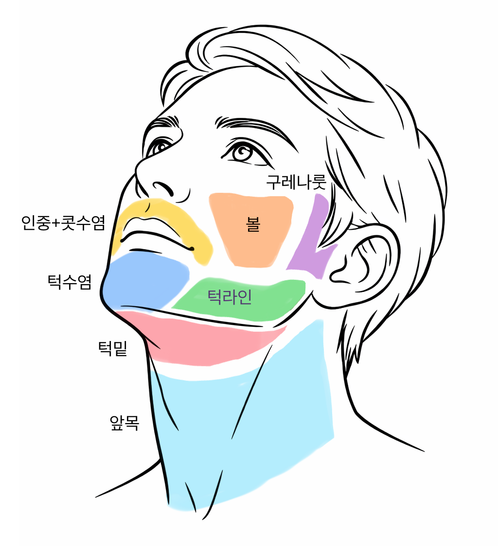 [남성] 젠틀맥스 시술 설명