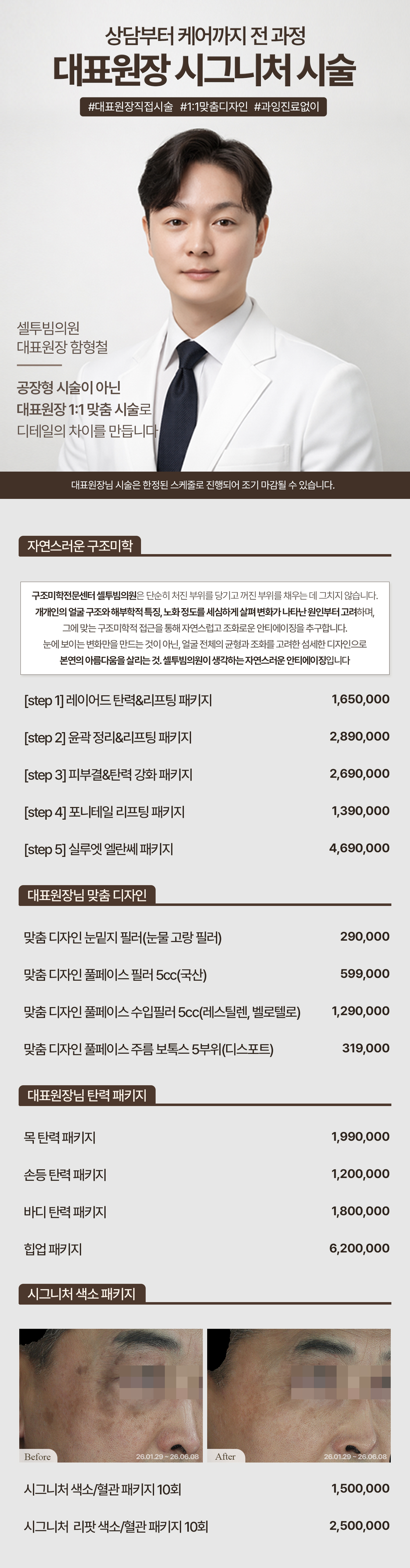 대표원장님 시그니처 시술