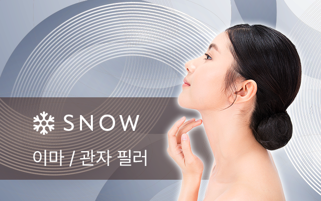 이마 / 관자 필러